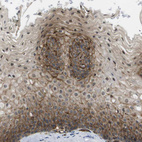 Anti-ZDHHC5 Antibody