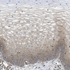 Immunohistochemical staining of human cervix, uterine shows membranous positivity in squamous epithelial cells.
