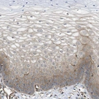 Immunohistochemical staining of human cervix, uterine shows membranous positivity in squamous epithelial cells.
