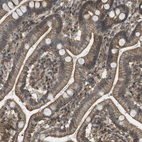 Immunohistochemical staining of human duodenum shows membranous positivity in glandular cells.