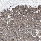 Immunohistochemical staining of human pancreas shows membranous positivity in exocrine glandular cells.