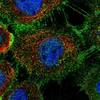 Immunofluorescent staining of human cell line A-431 shows localization to nucleoplasm, plasma membrane & cell junctions.
