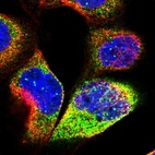 Immunofluorescent staining of human cell line A-431 shows localization to nuclear bodies & cytosol.
