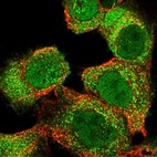 Immunofluorescent staining of human cell line A-431 shows localization to nucleoplasm, cytosol & vesicles.