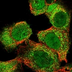 Immunofluorescent staining of human cell line A-431 shows localization to nucleoplasm, cytosol & vesicles.