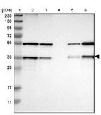 Lane 1: Marker [kDa] 230, 130, 95, 72, 56, 36, 28, 17, 11_br/_Lane 2: Human cell line RT-4_br/_Lane 3: Human cell line U-251MG sp_br/_Lane 4: Human plasma (IgG/HSA depleted)_br/_Lane 5: Human liver tissue_br/_Lane 6: Human tonsil tissue