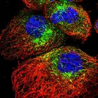 Immunofluorescent staining of human cell line A-431 shows localization to the Golgi apparatus & vesicles.