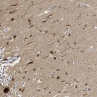 Anti-ZNF599 Antibody