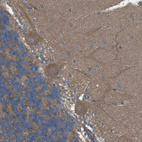 Anti-ZDHHC20 Antibody