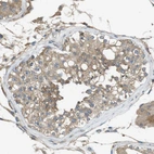 Immunohistochemical staining of human testis shows moderate cytoplasmic positivity in cells in seminiferous ducts.
