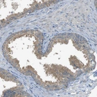 Immunohistochemical staining of human prostate shows moderate cytoplasmic positivity in glandular cells.