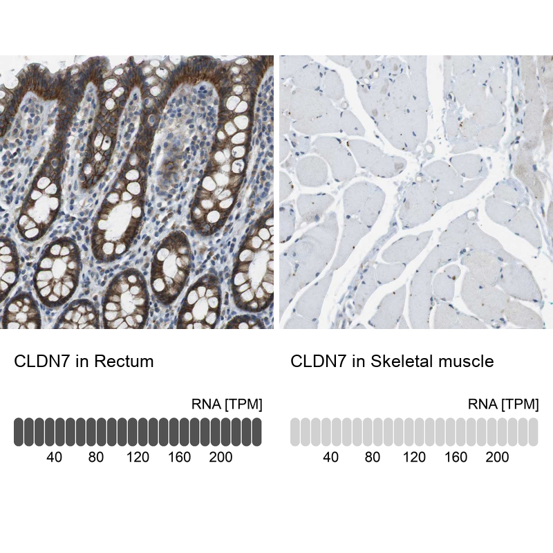 Anti-CLDN7 Antibody
