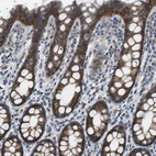 Immunohistochemical staining of human rectum shows high expression.