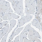Immunohistochemical staining of human skeletal muscle shows low expression as expected.