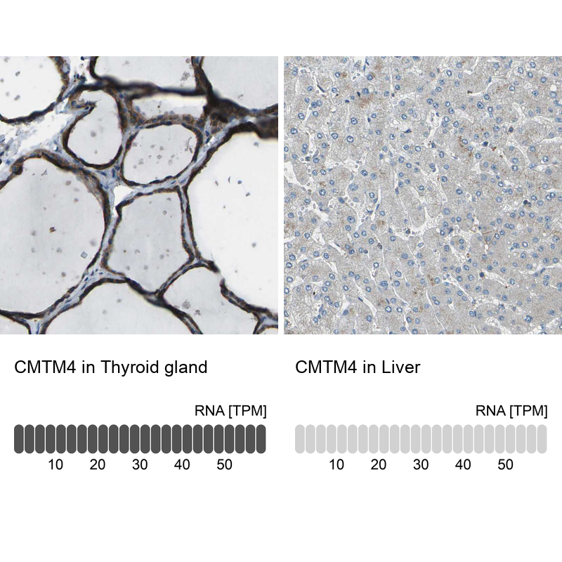 Anti-CMTM4 Antibody