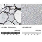 Anti-CMTM4 Antibody