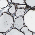 Immunohistochemical staining of human thyroid gland shows strong cytoplasmic positivity in glandular cells.