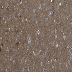 Immunohistochemical staining of human cerebral cortex shows strong positivity in neuropil.