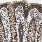 Immunohistochemical staining of human rectum shows strong cytoplasmic positivity in glandular cells.