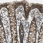 Immunohistochemical staining of human rectum shows strong cytoplasmic positivity in glandular cells.