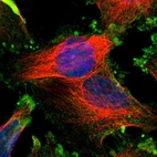 Immunofluorescent staining of human cell line U-251 MG shows localization to plasma membrane.
