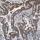 Immunohistochemical staining of human colon shows strong cytoplasmic positivity in glandular cells.