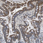 Immunohistochemical staining of human colon shows strong cytoplasmic positivity in glandular cells.