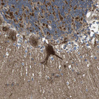 Immunohistochemical staining of human cerebellum shows strong cytoplasmic positivity in Purkinje cells.