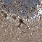 Immunohistochemical staining of human cerebellum shows strong cytoplasmic positivity in Purkinje cells.