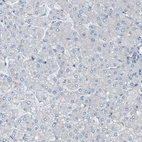 Immunohistochemical staining of human liver shows no positivity in hepatocytes as expected.