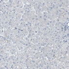 Immunohistochemical staining of human liver shows no positivity in hepatocytes as expected.