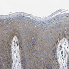 Immunohistochemical staining of human skin shows moderate to strong positivity in plasma membrane in keratinocytes.