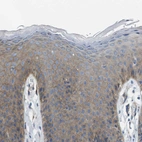 Immunohistochemical staining of human skin shows moderate to strong positivity in plasma membrane in keratinocytes.