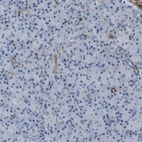Immunohistochemical staining of human pancreas shows moderate to strong cytoplasmic positivity in exocrine glandular cells.
