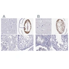 Anti-GJA8 Antibody