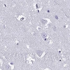 Immunohistochemical staining of human cerebral cortex using Anti-GJA8 antibody HPA014715.