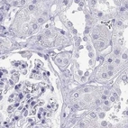 Immunohistochemical staining of human kidney using Anti-GJA8 antibody HPA014715.