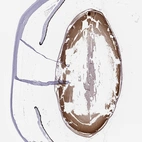 Immunohistochemical staining of human eye using Anti-GJA8 antibody HPA014715.