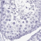 Immunohistochemical staining of human testis using Anti-GJA8 antibody HPA014715.