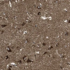 Immunohistochemical staining of human cerebral cortex shows strong granular cytoplasmic positivity in neurons.