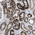 Immunohistochemical staining of human kidney shows strong granular cytoplasmic positivity in cells in tubules.