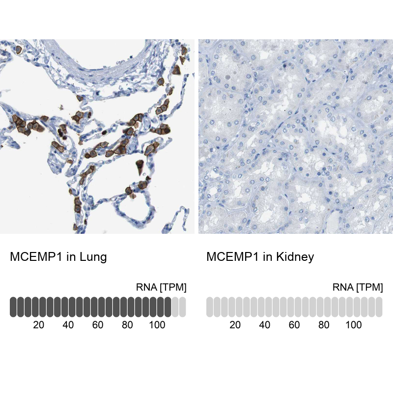 Anti-MCEMP1 Antibody