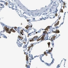 Immunohistochemical staining of human lung shows moderate membranous positivity in macrophages.