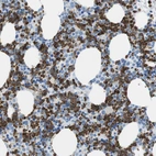 Immunohistochemical staining of human bone marrow shows moderate membranous positivity in hematopoietic cells.