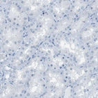 Immunohistochemical staining of human kidney shows no positivity in cells in tubules as expected.