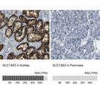 Anti-SLC13A3 Antibody