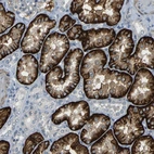 Immunohistochemical staining of human kidney shows strong membranous positivity in cells in proximal tubules.