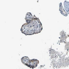 Immunohistochemical staining of human placenta shows moderate membranous positivity in trophoblastic cells.