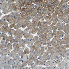 Immunohistochemical staining of human liver shows moderate membranous positivity in hepatocytes.