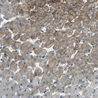 Immunohistochemical staining of human liver shows moderate membranous positivity in hepatocytes.